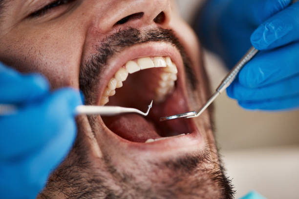 Best Wisdom Tooth Removal  in Pinehurst, MA